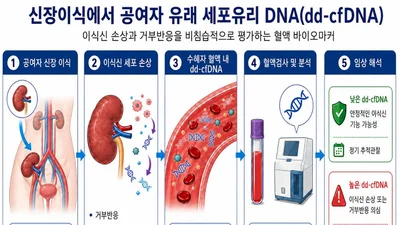 신장이식 후 불필요한 조직검사 줄인다, 거부반응 정밀 선별 입증