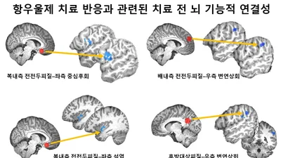 청소년 우울증 항우울제 치료 반응, 치료 전 ‘뇌 기능적 연결성’ 예측