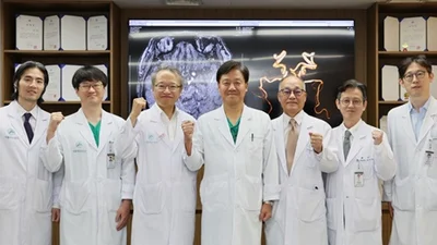 서울아산병원, 국내 첫 뇌동맥류(뇌 속 시한폭탄)치료 2만 례 달성
