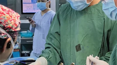꿈의 레이저 뇌전증 수술 한·중 협력으로 최초 성공