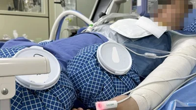 한림화상재단·더멀매트릭스, 화상환자 위한 동행 8년째