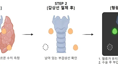 분당서울대병원 외과 최준영·이자경 교수 연구팀