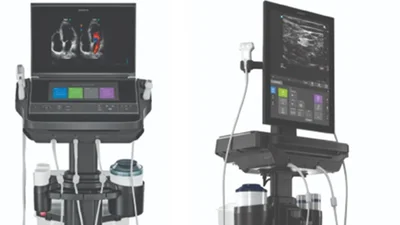 JW메디칼, 프리미엄 현장진단 초음파기기 ‘소노사이트 PX·ST’ 2종 출시