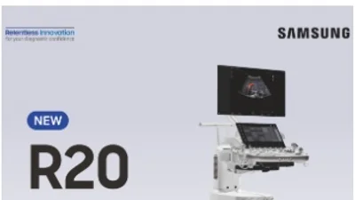 삼성메디슨, KCR서 R20 간 정량진단...정확도 단계별 90%이상