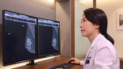 대림성모병원, 유방 진단 신기술 CEM 도입