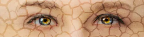 ▲안구건조는 눈물의 양 부족-눈물이 너무 빨리 증발하거나-눈물막의 균형이 불안정할 때도 생길 수 있다. 장시간 화면을 보면 눈 깜박임이 줄어 눈물이 쉽게 증발할 수 있으므로 작업 중에는 중간 휴식을 취하고, 실내가 지나치게 건조하지 않도록 관리하는 것이 좋다.