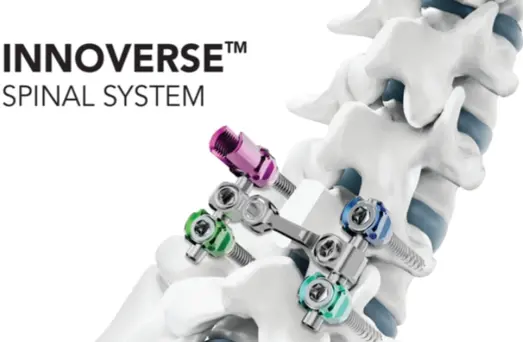 ▲시지메드텍의 척추 고정 장치 ‘이노버스 스파이널 시스템(INNOVERSE Spinal System)’