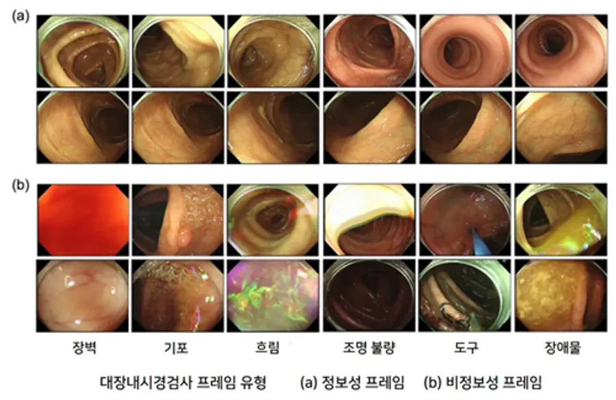 [이미지2] InfoColon 프레임 유형