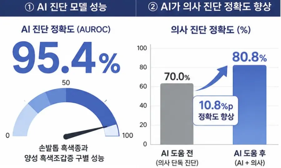 그림1 설명) AI 진단 모델의 손발톱 흑색종과 양성 흑색조갑증 구별 정확도는 95.4%를 기록했다. 또한 AI 도움을 받아 진단했을 때, 의사 진단 정확도가 10.8% 상승하는 결과를 보였다.