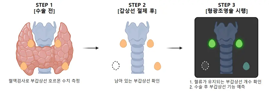 [그림] 형광조영술 기반 로봇 갑상선 후 부갑상선 기능 예측법 개념도